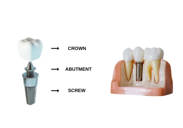 Cure Dental Issues