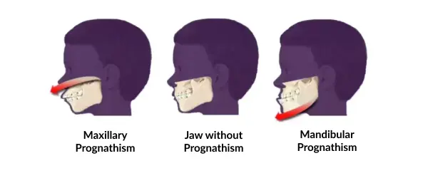 Cure Dental Issues