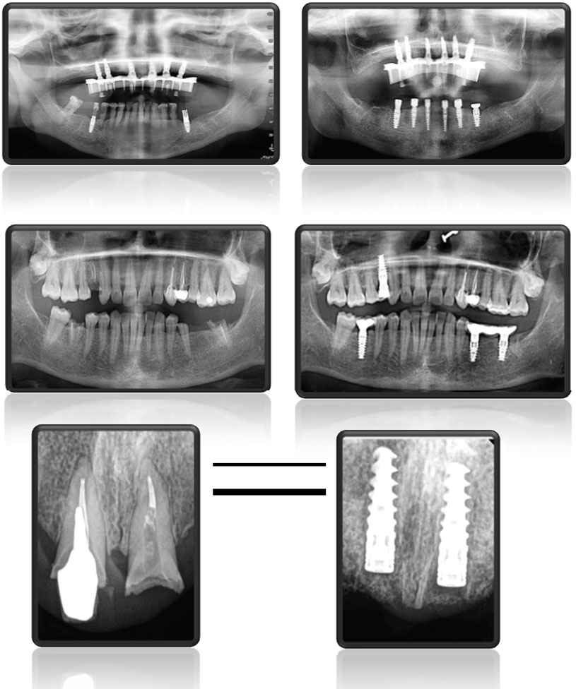 Cure Dental Issues