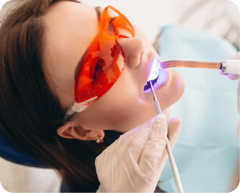 Advanced Microscopic & Laser Root Canal Treatment