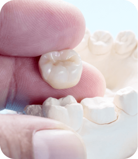 Post-Treatment Care & Follow-Up